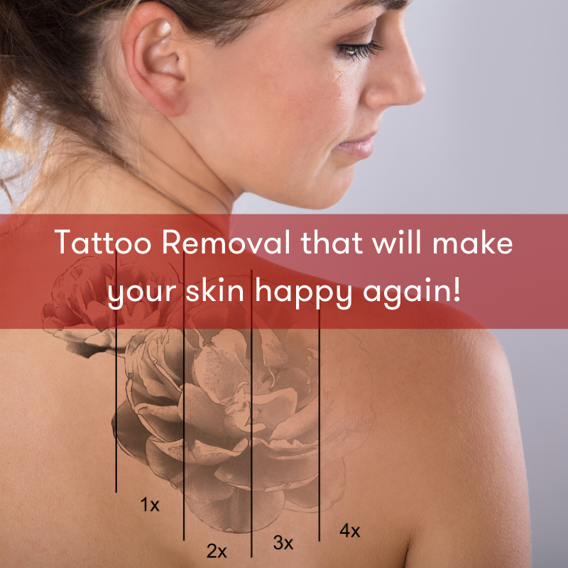 Neck  Face Laser Tattoo Removal Before  After Results  MEDermis