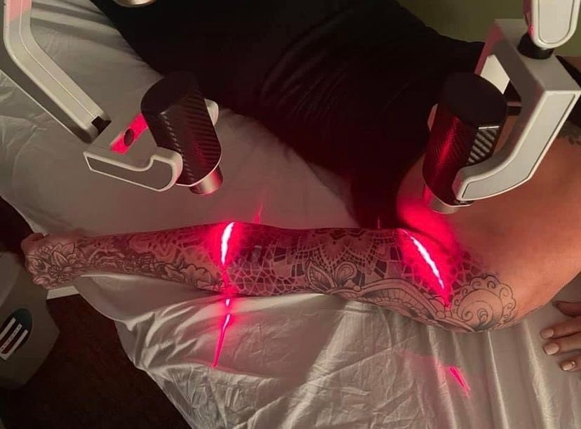 Tattoo Laser Photo